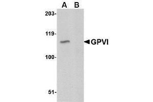 Image no. 1 for anti-Glycoprotein VI (Platelet) (GP6) (C-Term) antibody (ABIN342705) (GP6 anticorps  (C-Term))
