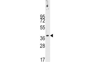 Western Blotting (WB) image for anti-Pancreatic and Duodenal Homeobox 1 (PDX1) antibody (ABIN3001419) (PDX1 anticorps)