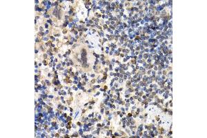 Immunohistochemistry of paraffin-embedded mouse spleen using RAD1 antibody (ABIN5995531) at dilution of 1/200 (40x lens). (RAD1 anticorps)