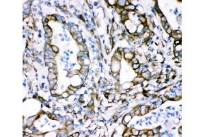 IHC analysis of Plectin using anti-Plectin antibody (ABIN3043900). (PLEC anticorps  (Middle Region))