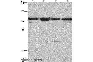 Western blot analysis of HUVEC, NIH/3T3, Hela and 293T cell, using KLF11 Polyclonal Antibody at dilution of 1:350 (KLF11 anticorps)