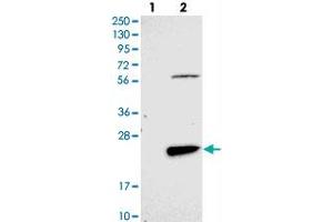 Western blot analysis of Lane 1: Negative control (vector only transfected HEK293T lysate), Lane 2: Over-expression Lysate (Co-expressed with a C-terminal myc-DDK tag (~3. (FAM167B anticorps)