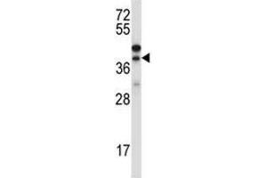 Western blot testing of CTGF antibody and NCI-H460 lysate