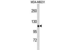 Image no. 1 for anti-Actinin, alpha 1 (ACTN1) (N-Term) antibody (ABIN452717) (ACTN1 anticorps  (N-Term))