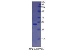 SDS-PAGE analysis of Cow MHCDRa Protein. (HLA-DRA Protéine)