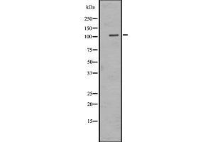 Western blot analysis of EMR1 expression in HEK293 cells ,The lane on the left is treated with the antigen-specific peptide.