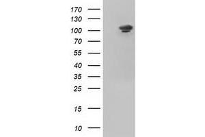 Image no. 5 for anti-Ubiquitin Specific Peptidase 5 (USP5) antibody (ABIN1501693)