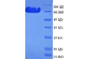 SDS-PAGE (SDS) image for tau Protein (AA 2-752) protein (His tag) (ABIN5709913)