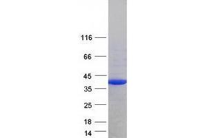 Validation with Western Blot