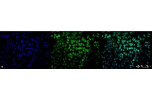 Immunocytochemistry/Immunofluorescence analysis using Rabbit Anti-TNF-R1 Polyclonal Antibody . (TNFRSF1A anticorps  (AA 20-43) (FITC))
