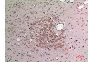 Immunohistochemistry (IHC) analysis of paraffin-embedded Rat Brain, antibody was diluted at 1:100. (FGF9 anticorps  (C-Term))