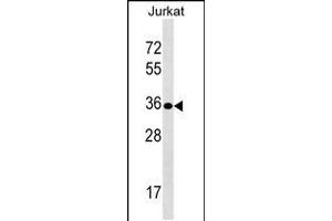 Western blot analysis in Jurkat cell line lysates (35ug/lane). (Uroplakin 3B anticorps  (AA 192-219))
