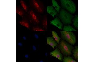 ABIN6258131 and ABIN6275518 staining  cells by IF/ICC. (DVL2 anticorps  (C-Term))