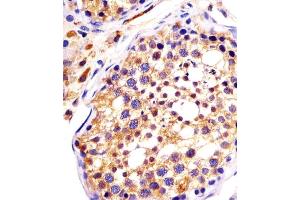 (ABIN6242987 and ABIN6578147) staining DYNC1H1 in human testis sections by Immunohistochemistry (IHC-P - paraformaldehyde-fixed, paraffin-embedded sections).
