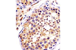 (ABIN6242987 and ABIN6578147) staining DYNC1H1 in human testis sections by Immunohistochemistry (IHC-P - paraformaldehyde-fixed, paraffin-embedded sections). (DYNC1H1 anticorps  (C-Term))