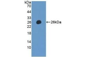 Detection of Recombinant LILRB2, Human using Polyclonal Antibody to Leukocyte Immunoglobulin Like Receptor Subfamily B, Member 2 (LILRB2)