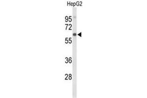 Western blot analysis of AFM Antibody (N-term) in HepG2 cell line lysates (35µg/lane). (Afamin anticorps  (N-Term))