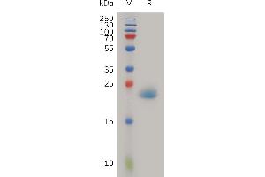 Human PGL Protein, His Tag on SDS-PAGE under reducing condition.