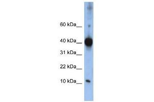 LSM4 antibody used at 1 ug/ml to detect target protein. (LSM4 anticorps)