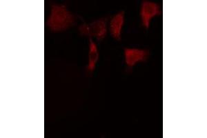 ABIN6274926 staining HeLa cells by IF/ICC.