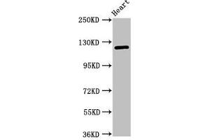 Western Blot Positive WB detected in: Mouse heart tissue All lanes: SEMA5B antibody at 1 μg/mL Secondary Goat polyclonal to rabbit IgG at 1/50000 dilution Predicted band size: 126, 120, 124, 132 kDa Observed band size: 126 kDa (SEMA5B anticorps  (AA 845-1013))