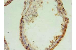 Immunohistochemistry of paraffin-embedded human testis tissue using ABIN7159148 at dilution of 1:100