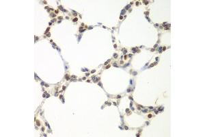 Immunohistochemistry of paraffin-embedded mouse lung using VRK1 antibody (ABIN5975628) at dilution of 1/100 (40x lens). (VRK1 anticorps)