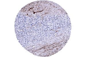 Cerebellum molecular layer Purkinje cell layer granule cell layer white matter A strong Calbindin 1 staining of Purkinje cells and of associated axonal fibres is seen in the cerebrum (CALB1 anticorps  (AA 7-96))
