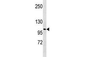LOXL2 antibody western blot analysis in A549 lysate. (LOXL2 anticorps  (AA 589-617))