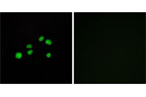 Immunofluorescence analysis of HepG2 cells, using Collagen XXIII α1 antibody. (COL23A1 anticorps)