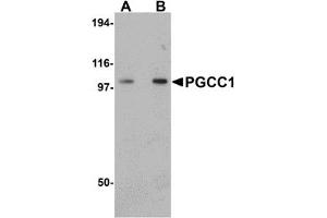 Western Blotting (WB) image for anti-Family with Sequence Similarity 120B (FAM120B) (C-Term) antibody (ABIN1030576) (FAM120B anticorps  (C-Term))