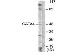 Western blot analysis of extracts from COLO205 cells, treated with Serum 20% 15', using GATA4 (Ab-262) Antibody. (GATA4 anticorps  (AA 228-277))