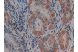 Used in DAB staining on fromalin fixed paraffin- embedded liver tissue (Thrombospondin 1 anticorps  (AA 24-221))