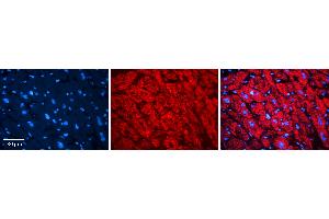 Rabbit Anti-alpha-DAG1 Antibody   Formalin Fixed Paraffin Embedded Tissue: Human heart Tissue Observed Staining: Cytoplasmic Primary Antibody Concentration: N/A Other Working Concentrations: 1:600 Secondary Antibody: Donkey anti-Rabbit-Cy3 Secondary Antibody Concentration: 1:200 Magnification: 20X Exposure Time: 0. (Dystroglycan anticorps  (Middle Region))