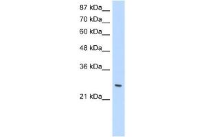 WB Suggested Anti-ZNF575 Antibody Titration:  1. (ZNF575 anticorps  (C-Term))