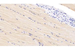 Detection of VEGFD in Bovine Skeletal muscle Tissue using Polyclonal Antibody to Vascular Endothelial Growth Factor D (VEGFD) (VEGFD anticorps  (AA 89-354))