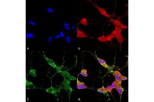 Immunocytochemistry/Immunofluorescence analysis using Mouse Anti-TrpC5 Monoclonal Antibody, Clone N67/15 (ABIN2485382).