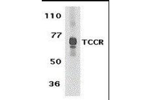 Western Blotting (WB) image for anti-Interleukin 27 Receptor, alpha (IL27RA) (C-Term) antibody (ABIN2474995) (IL27 Receptor alpha anticorps  (C-Term))