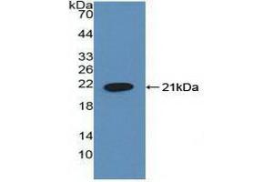Detection of Recombinant HLTF, Human using Polyclonal Antibody to Helicase Like Transcription Factor (HLTF) (HLTF anticorps  (AA 837-996))