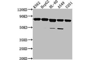 Western Blot Positive WB detected in: K562 whole cell lysate, HepG2 whole cell lysate, HL-60 whole cell lysate, A549 whole cell lysate, U251 whole cell lysate All lanes: TMEM214 antibody at 1:2000 Secondary Goat polyclonal to rabbit IgG at 1/50000 dilution Predicted band size: 78, 73 kDa Observed band size: 78 kDa (TMEM214 anticorps  (AA 2-236))