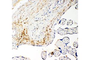 Anti-SLC16A4 antibody, IHC(P) IHC(P): Human Placenta Cancer Tissue