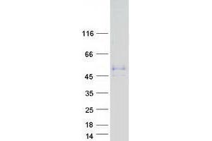 Validation with Western Blot