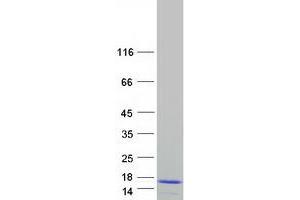 Validation with Western Blot
