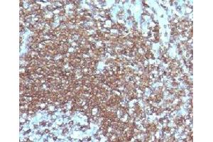 IHC testing of FFPE human tonsil with ICAM3 antibody. (ICAM-3/CD50 anticorps)