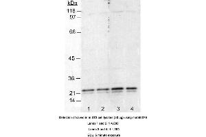 Image no. 2 for anti-Caveolin 1, Caveolae Protein, 22kDa (CAV1) antibody (ABIN363230) (Caveolin-1 anticorps)