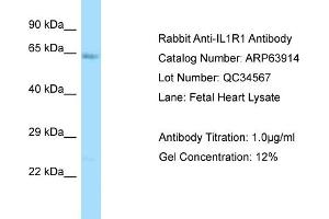 Western Blotting (WB) image for anti-Interleukin 1 Receptor, Type I (IL1R1) (C-Term) antibody (ABIN2789664)