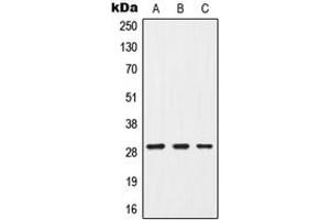 Western blot analysis of G18 expression in MCF7 (A), mouse brain (B), PC12 (C) whole cell lysates. (GPSM3 anticorps  (Center))
