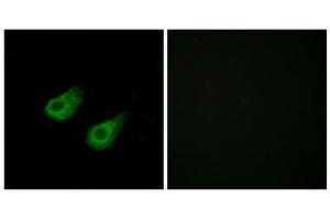 Immunofluorescence analysis of HeLa cells, using JIP3 antibody. (JIP3 anticorps  (Internal Region))