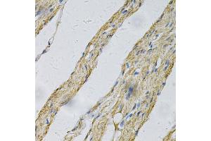 Immunohistochemistry of paraffin-embedded human smooth muscle using PRNP Antibody (ABIN5971407) at dilution of 1/100 (40x lens). (PRNP anticorps)