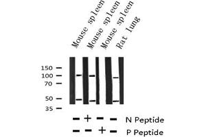 Western blot analysis of Phospho-NF kappaB p105/p50 (Ser337) expression in various lysates